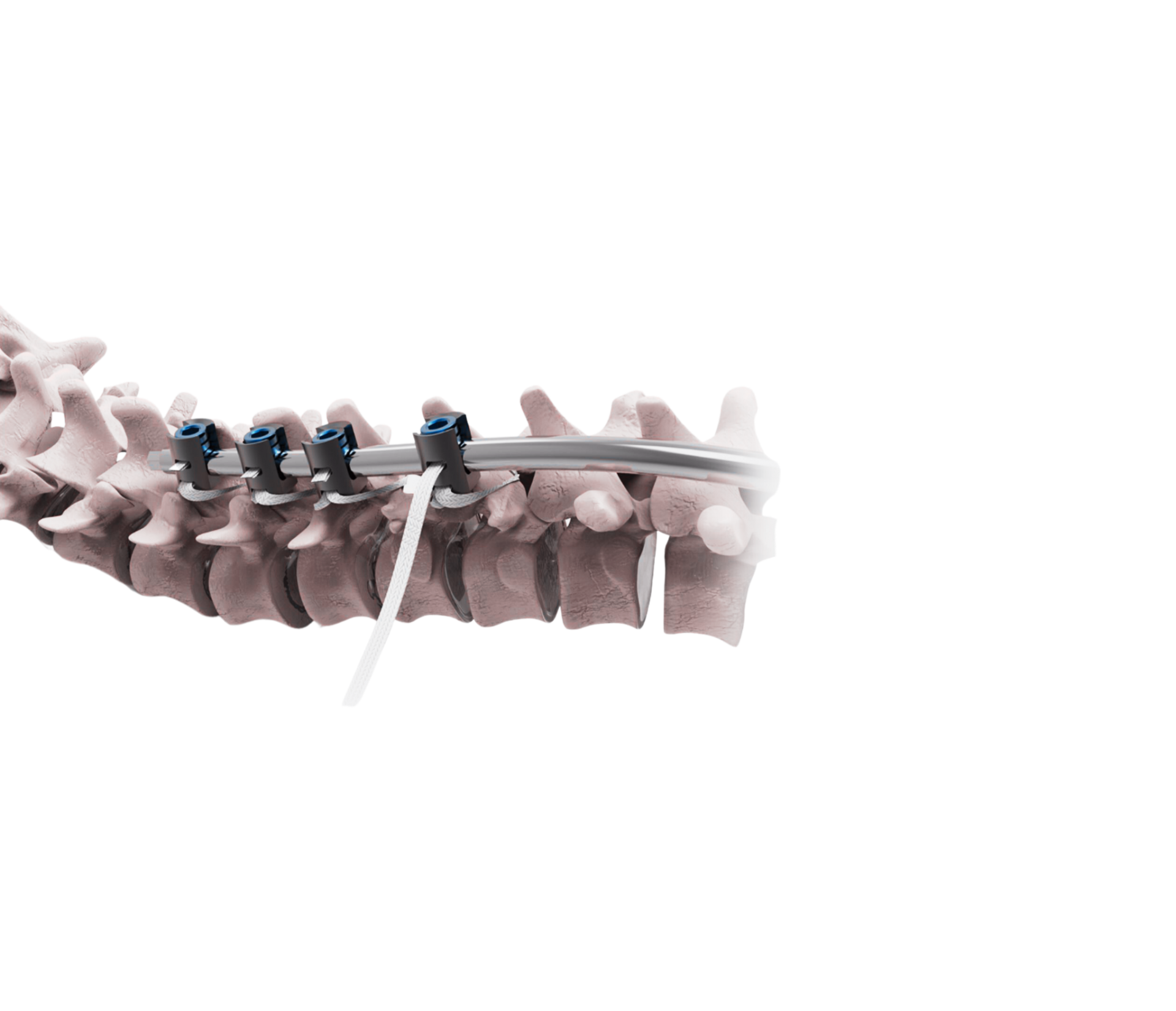Spine